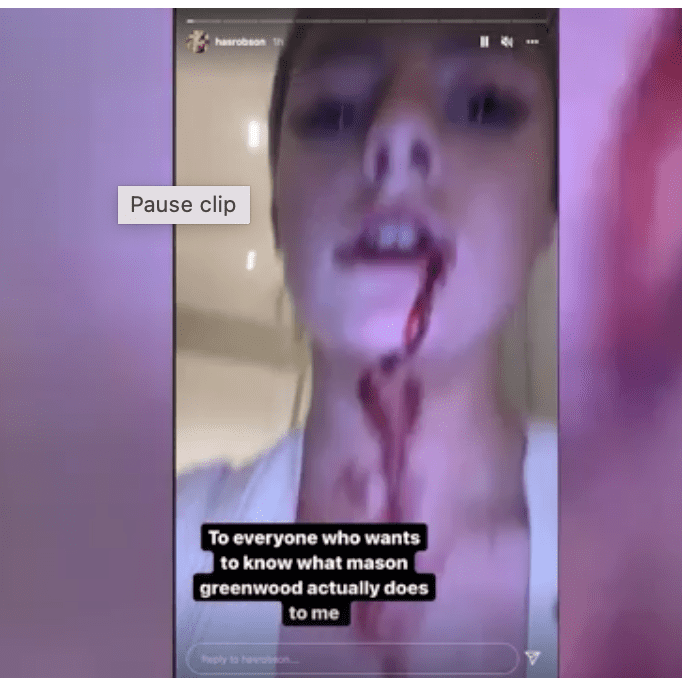 Mason Greenwood Girlfriend Video: Full Detail Inside 1 Mason Greenwood Video